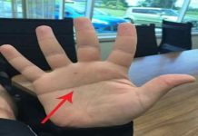 Xem chỉ tay chữ Y đoán vận mênh, tình duyên của con người