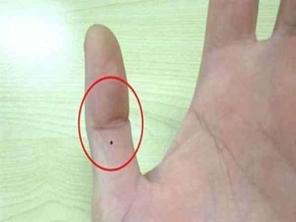 Nốt ruồi ở ngón tay cái có vận mệnh tốt hay xấu